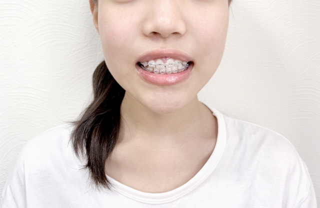 歯科矯正治療の痛みを軽減させる方法について