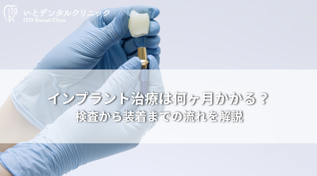 インプラント治療は何ヶ月かかる？検査から装着までの流れを解説