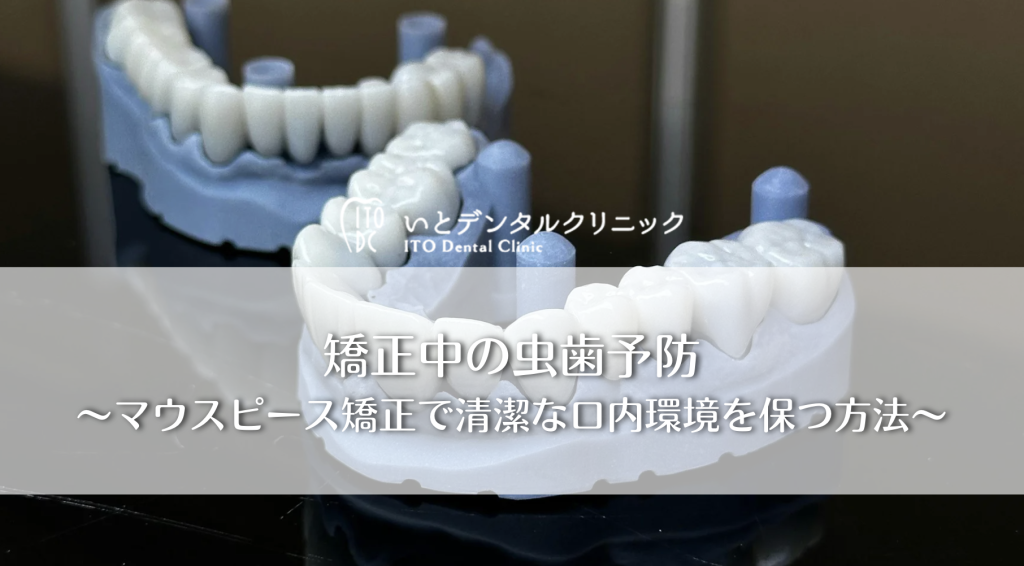 矯正中の虫歯予防〜マウスピース矯正で清潔な口内環境を保つ方法〜