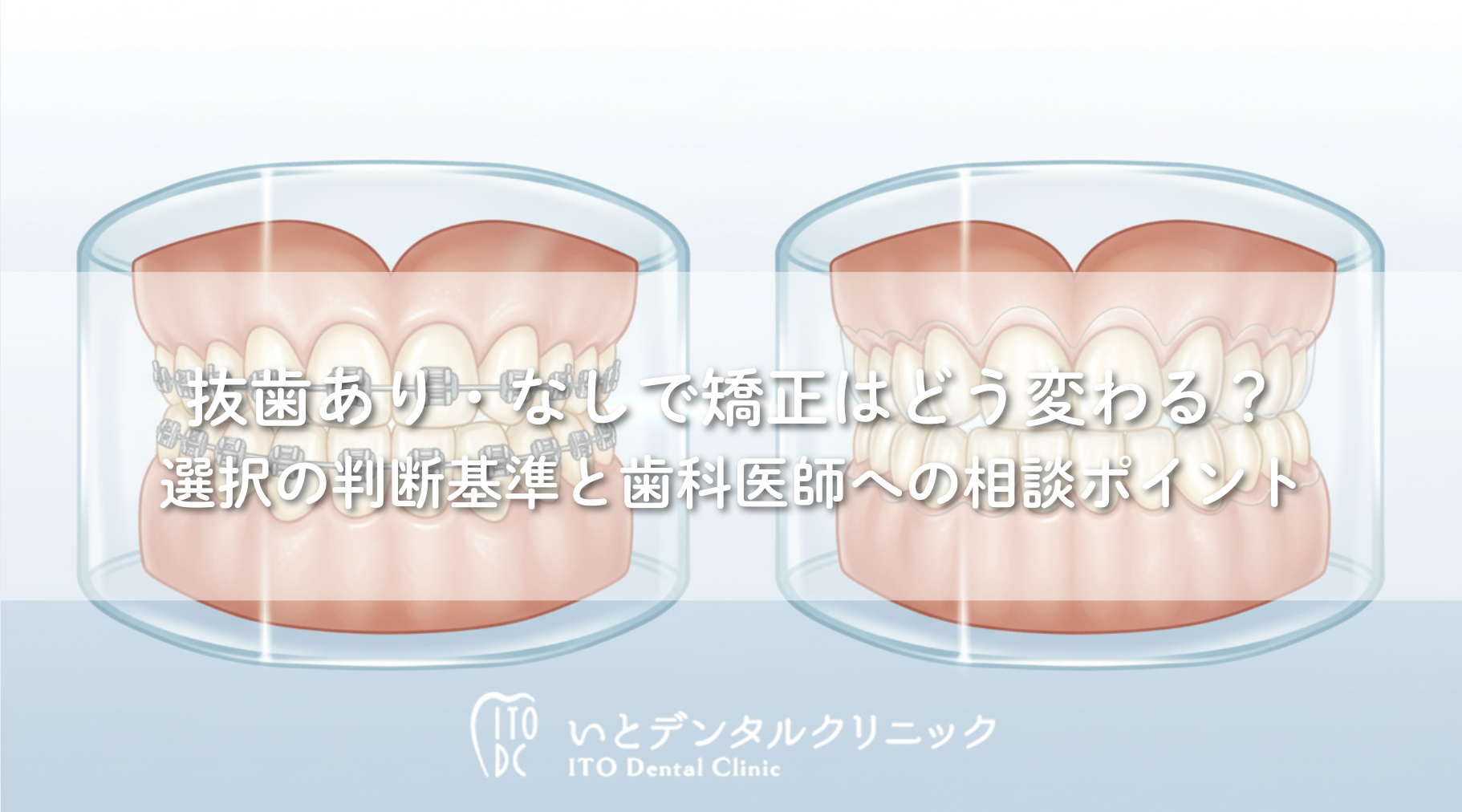 抜歯あり・なしで矯正はどう変わる？選択の判断基準と歯科医師への相談