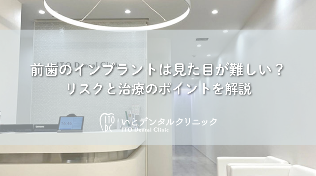 前歯のインプラントは見た目が難しい？リスクと治療のポイントを解説
